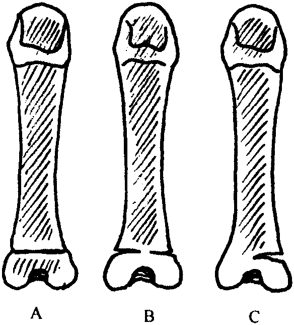 第一節(jié) 概論